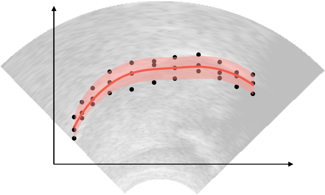 Smoothing spline ANOVA on an ultrasound image