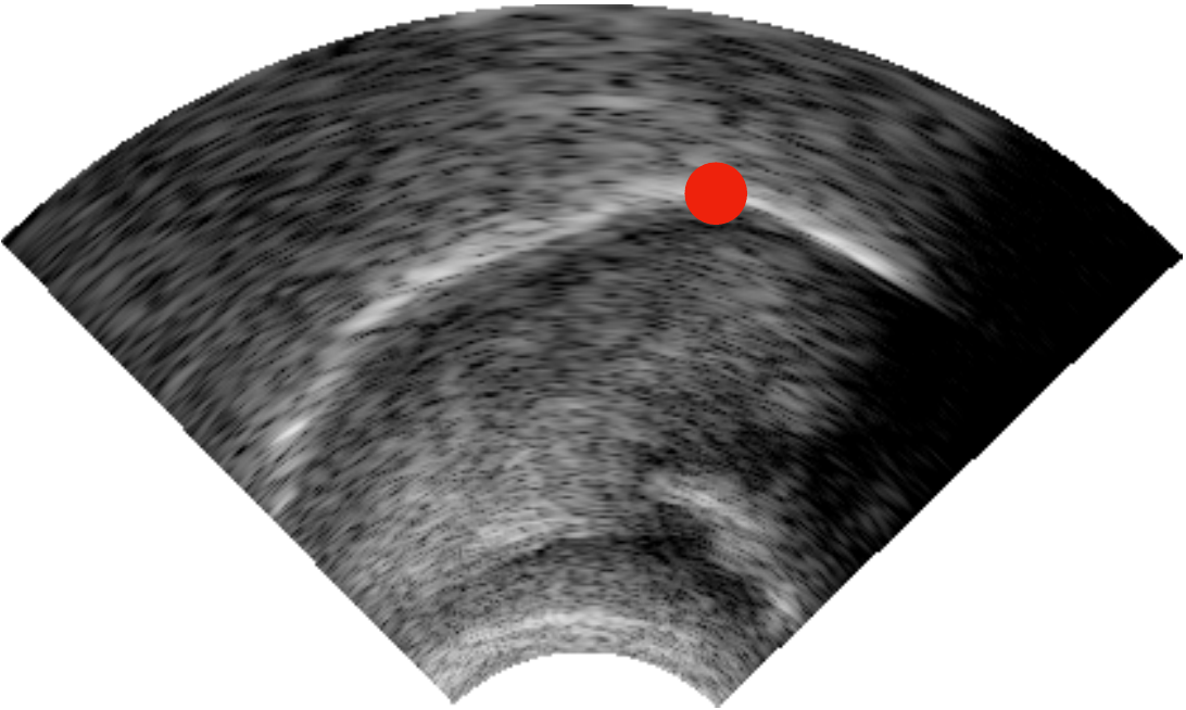 A point on a tongue surface in an ultrasound image