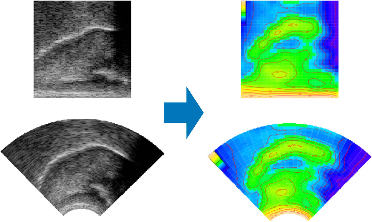 Whole-image GAM analysis on an ultrasound image