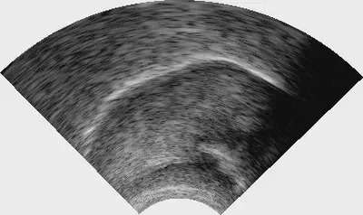 An example ultrasound image